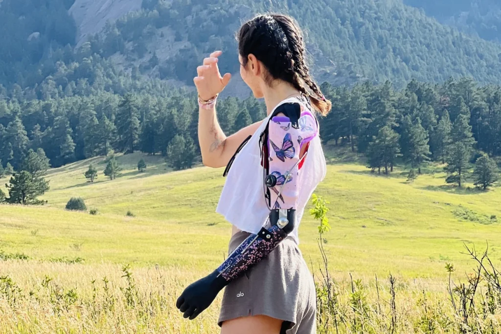 ساخت دست مصنوعی برای معلولین