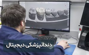 دندانپزشکی دیجیتال تجهیزات جدید