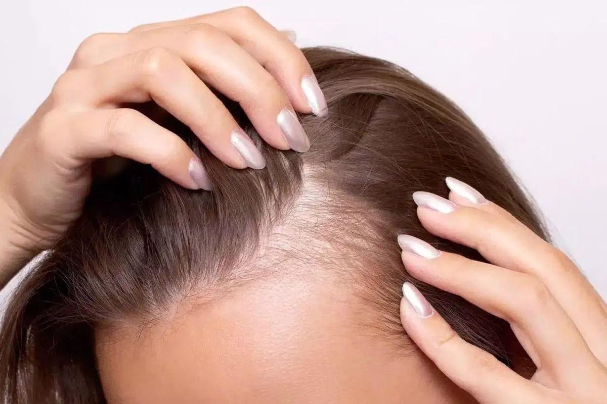 پیوند استرس و ریزش مو؛ یافته‌های تازه پژوهش سلول